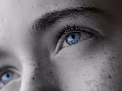 laser skin pigmentation treatment drbk clinic