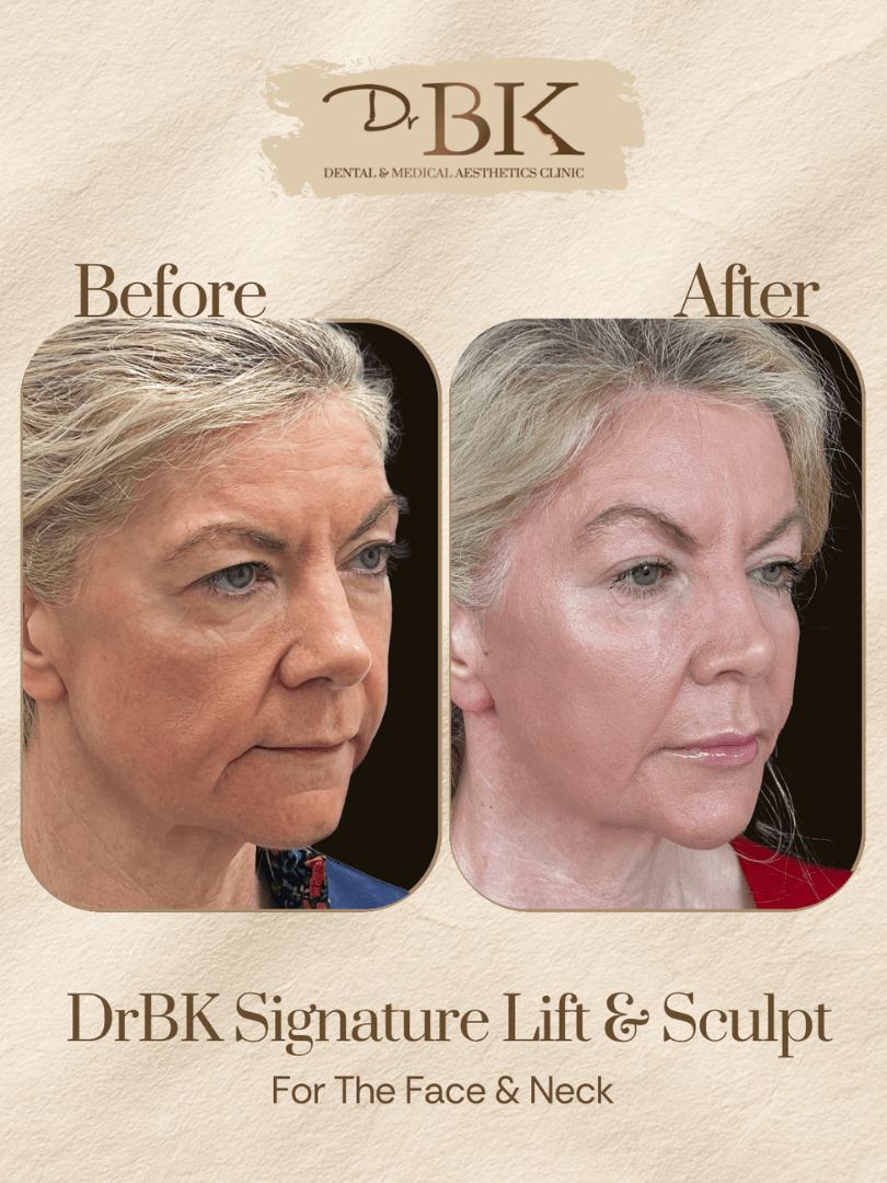 27 Before and after image of DrBK Signature Non-Surgical Facelift with Threads