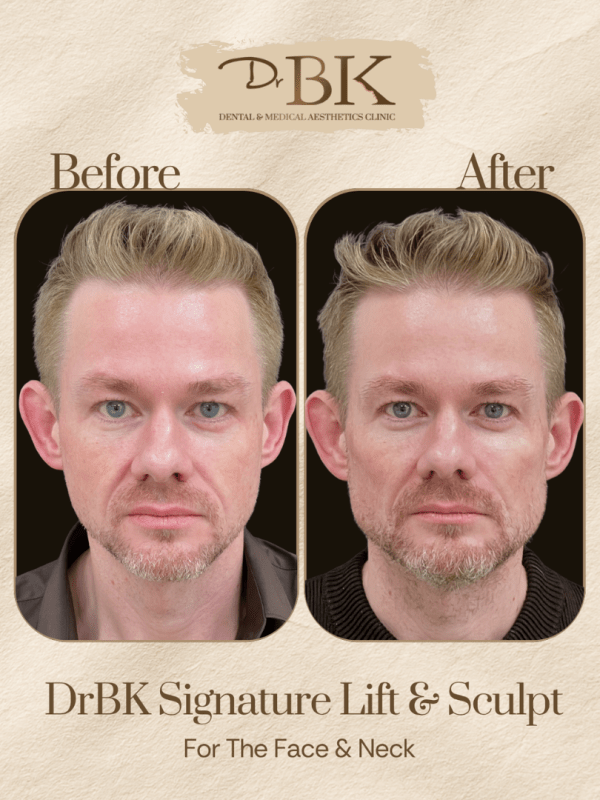 31 Before and after image of DrBK Signature Non-Surgical Facelift with Threads