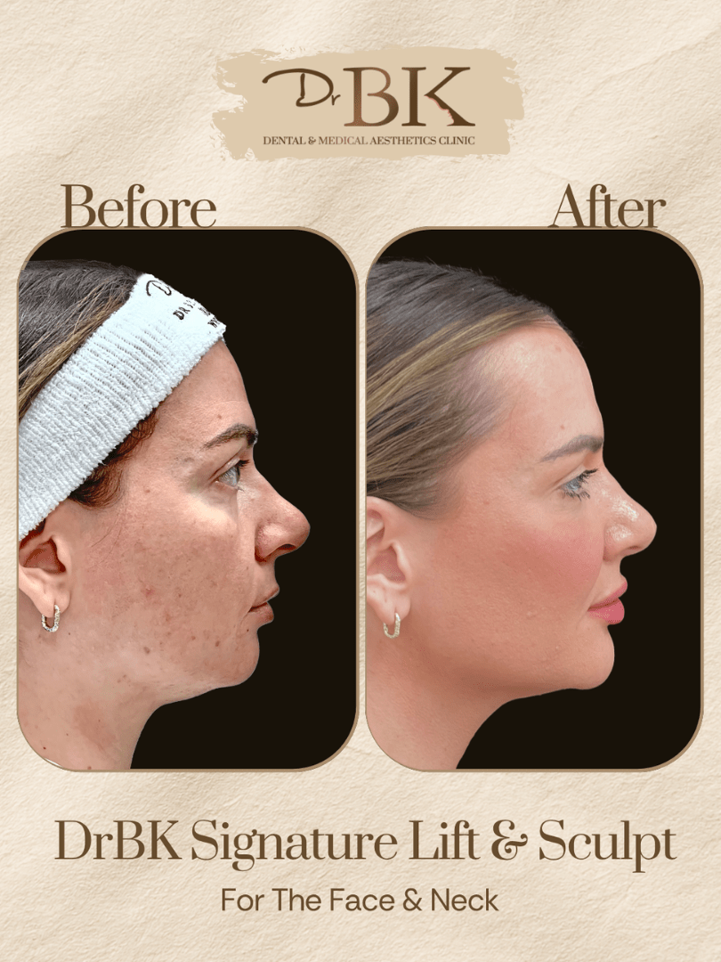 31 Before and after image of DrBK Signature Non-Surgical Facelift with Threads