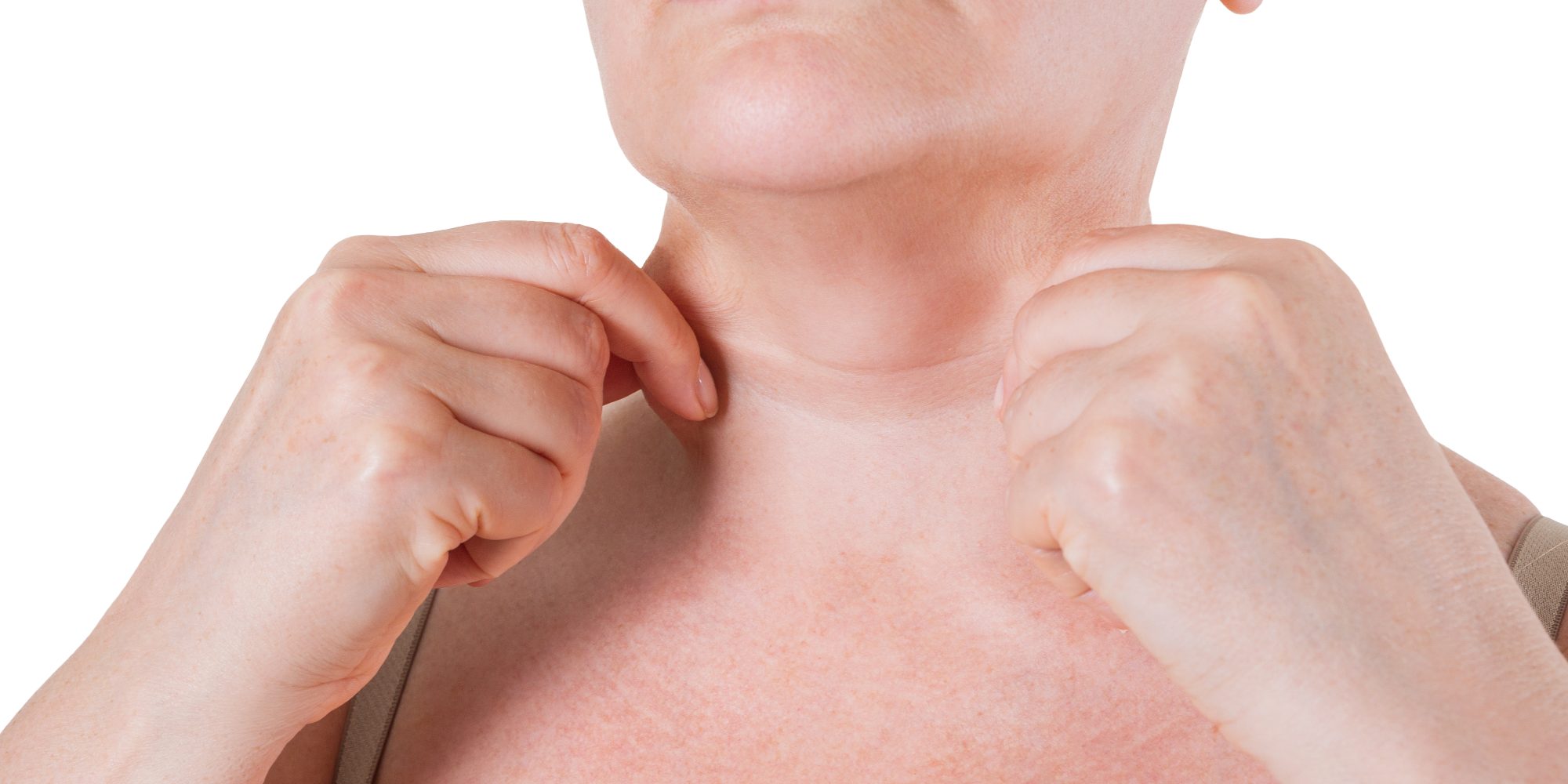 Flabby skin on the neck of an elderly woman, wrinkle treatment