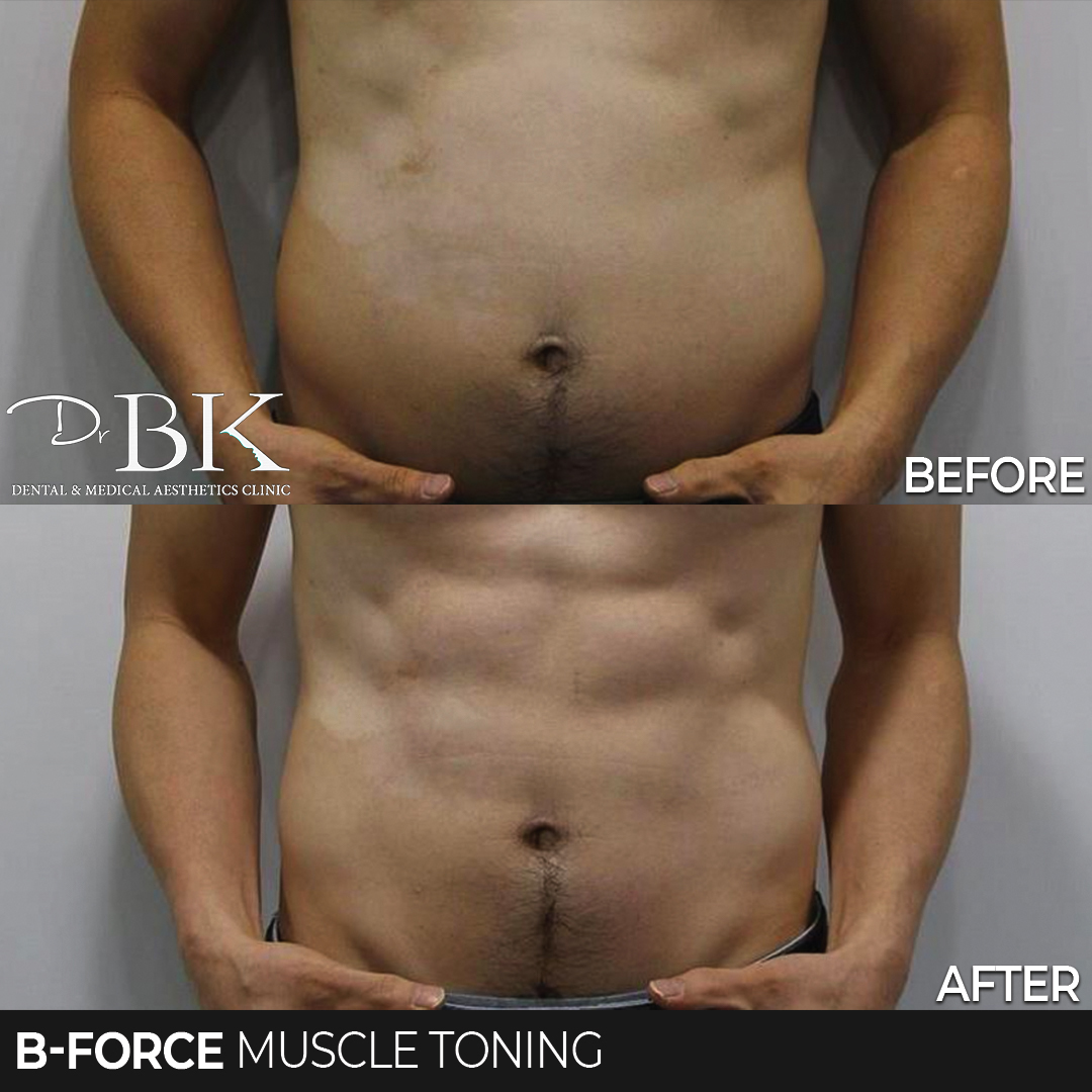 B-Force Muscle Toning
