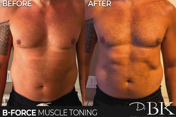 B-Force Muscle Toning