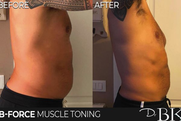 B-Force Muscle Toning