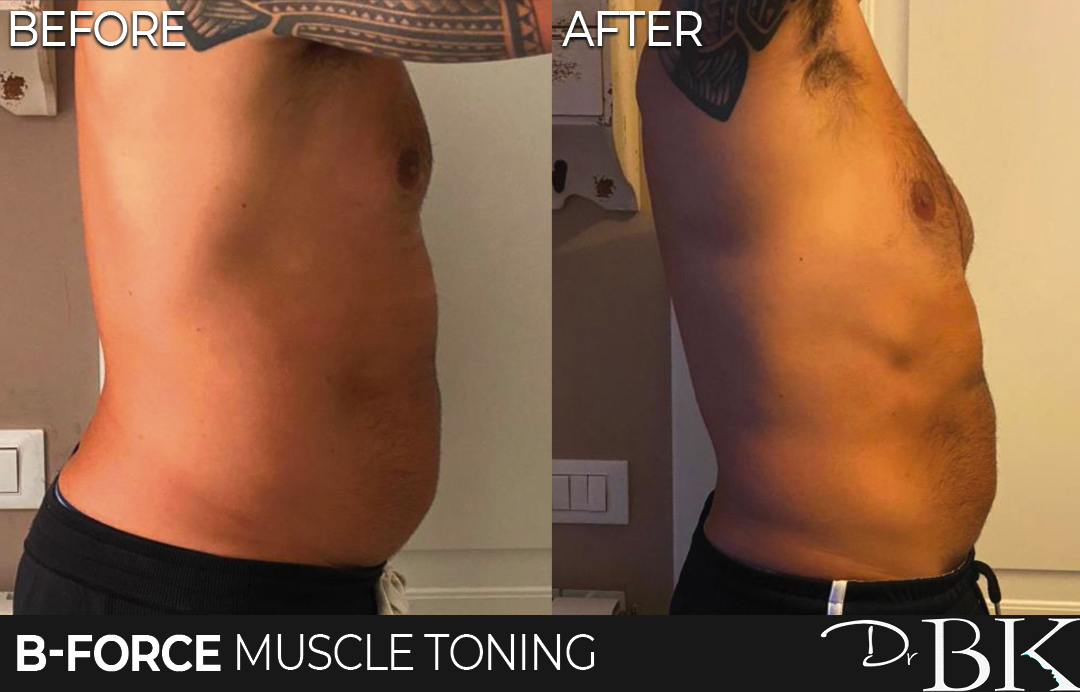 B-Force Muscle Toning