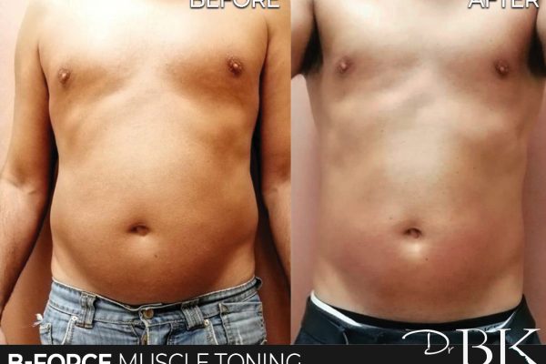 B-Force Muscle Toning