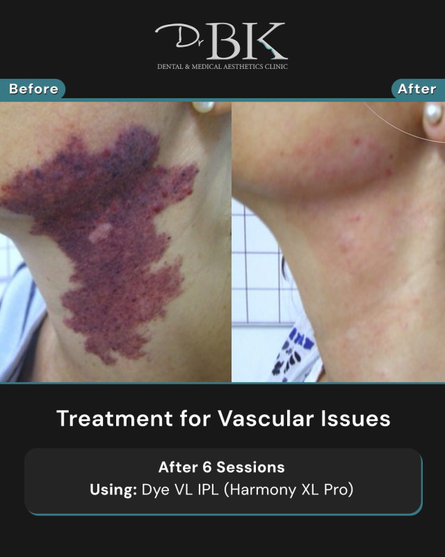 Before and After-Portrait Before and After-Portrait