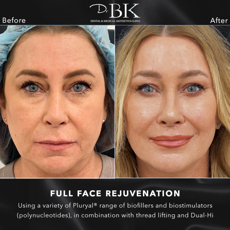 Before and After template2