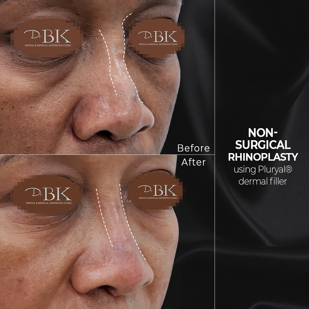 Halima-3-2 Halima-3-2