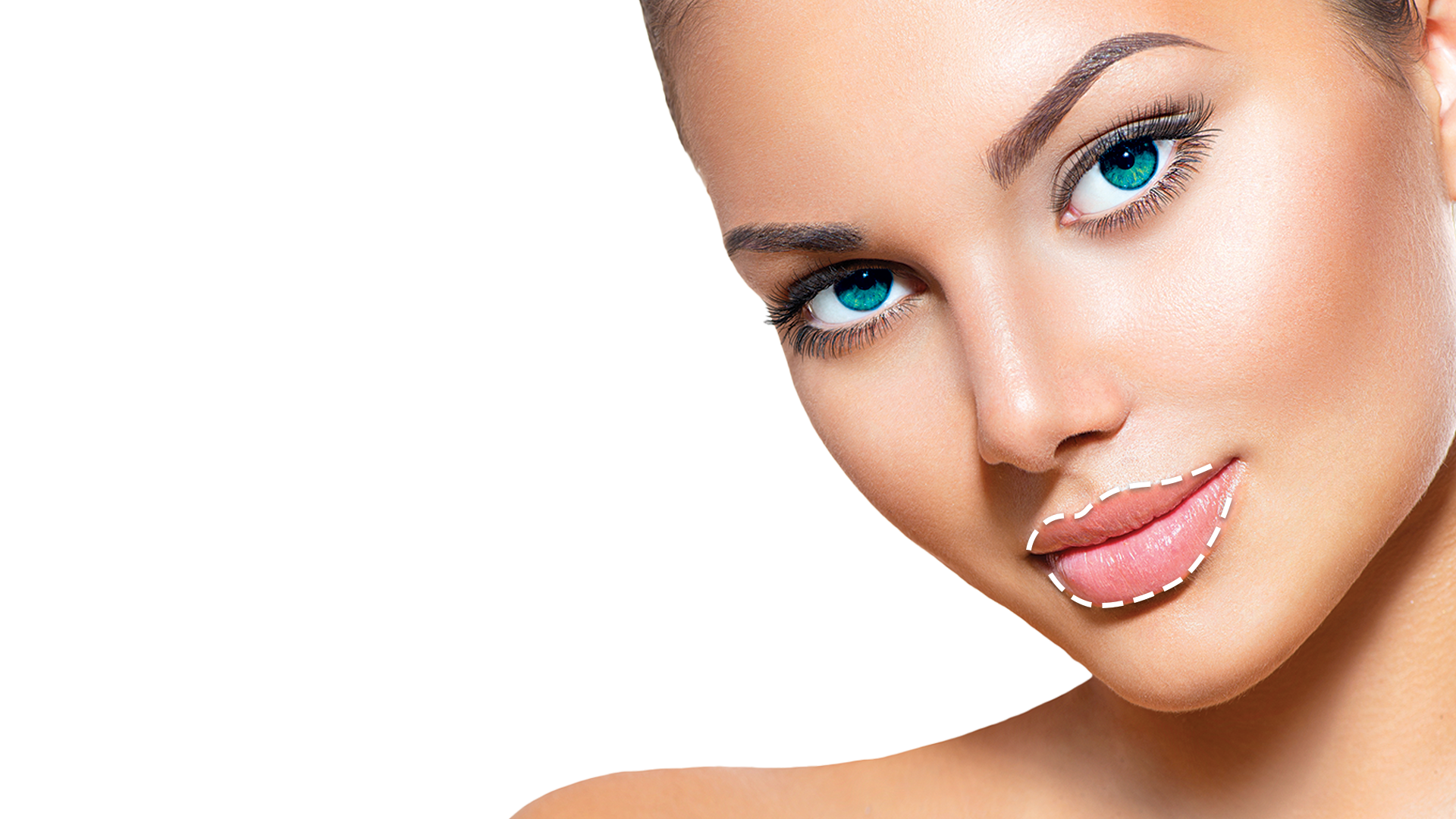 Lip Filler & Heart Lips® - DrBK Cosmetic Dentist & Aesthetics Clinic