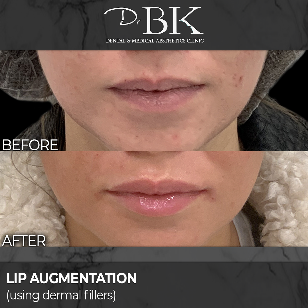 Before & After Gallery DrBK Cosmetic Dentist & Aesthetics Clinic