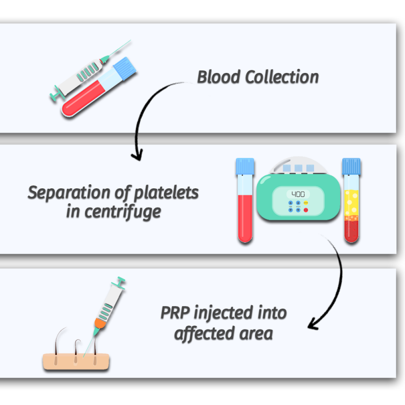 prp skin rejuvenation