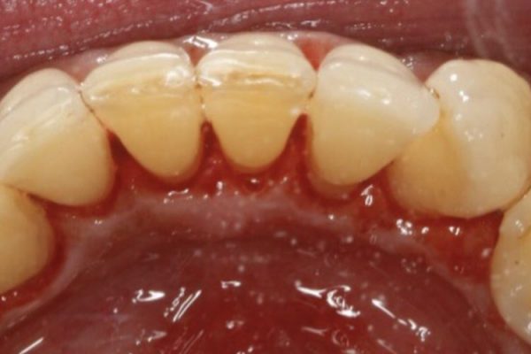 After Hygiene Appointment in Reading (DrBK Reading) Hygiene Appointments in Reading (DrBK Reading)