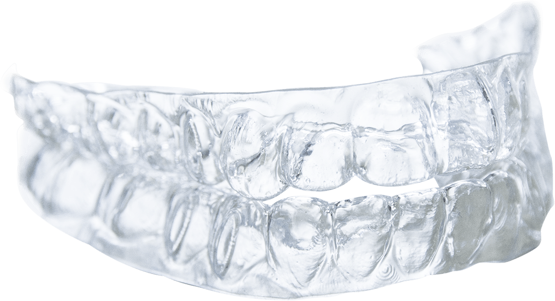clear aligners - orthodontics at drbk clear aligners