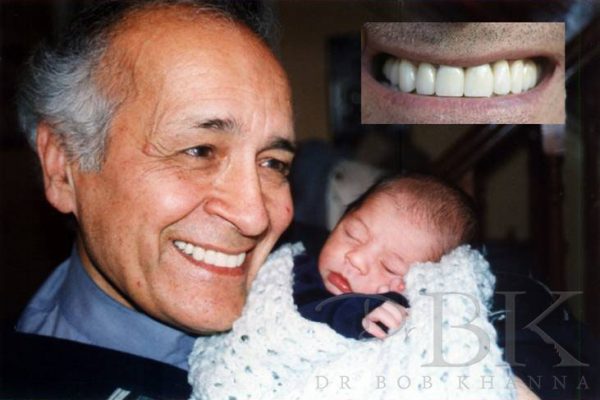 After Dental Implants After Dental Implants