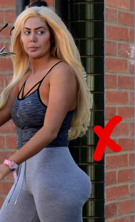 The non surgical BBL The safer alternative to the Brazilian Bum Lift