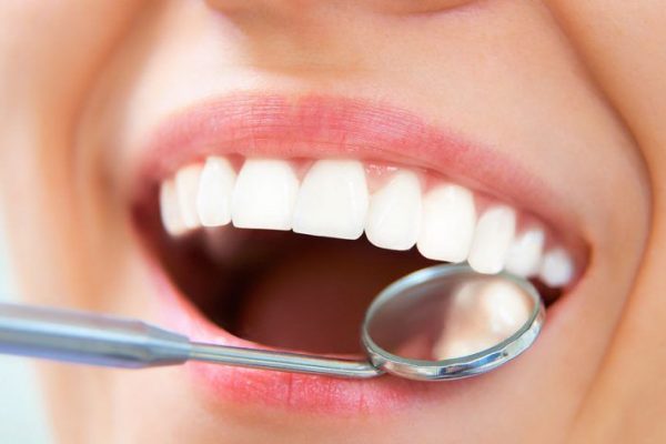 extensive routine dental examination 2
