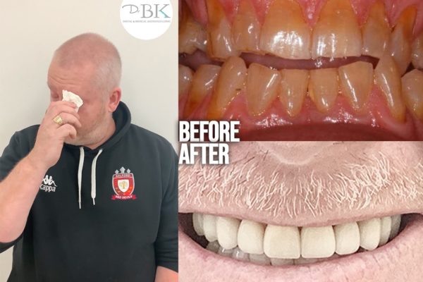 Dave-Journey-Cancer-Movember-DrBK