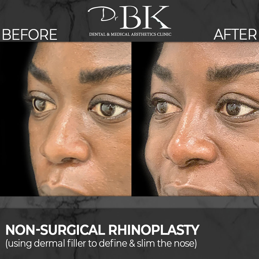 maria-side2 maria-side2