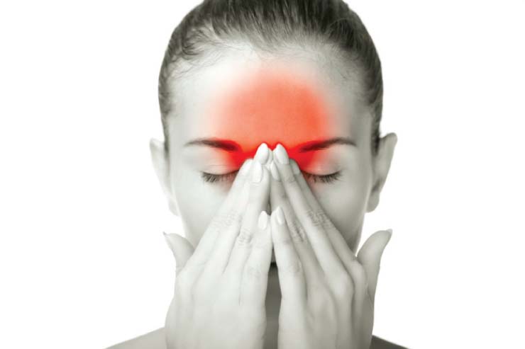 migraine