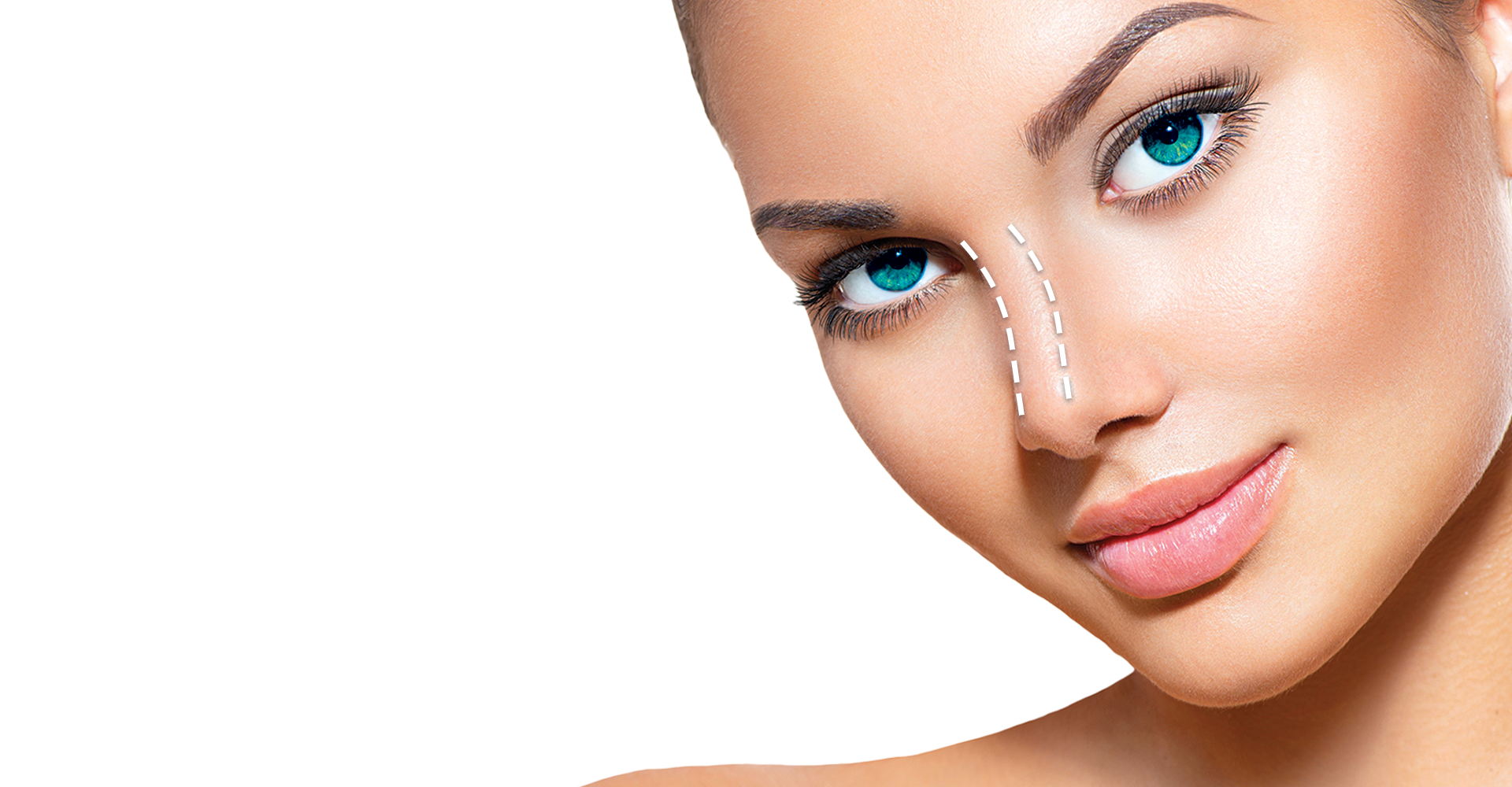 nose-filler-non-surgical-rhinoplasty