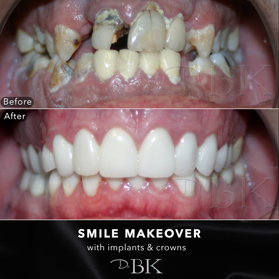 smilemakeover