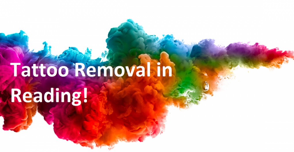 tattoo removal in reading