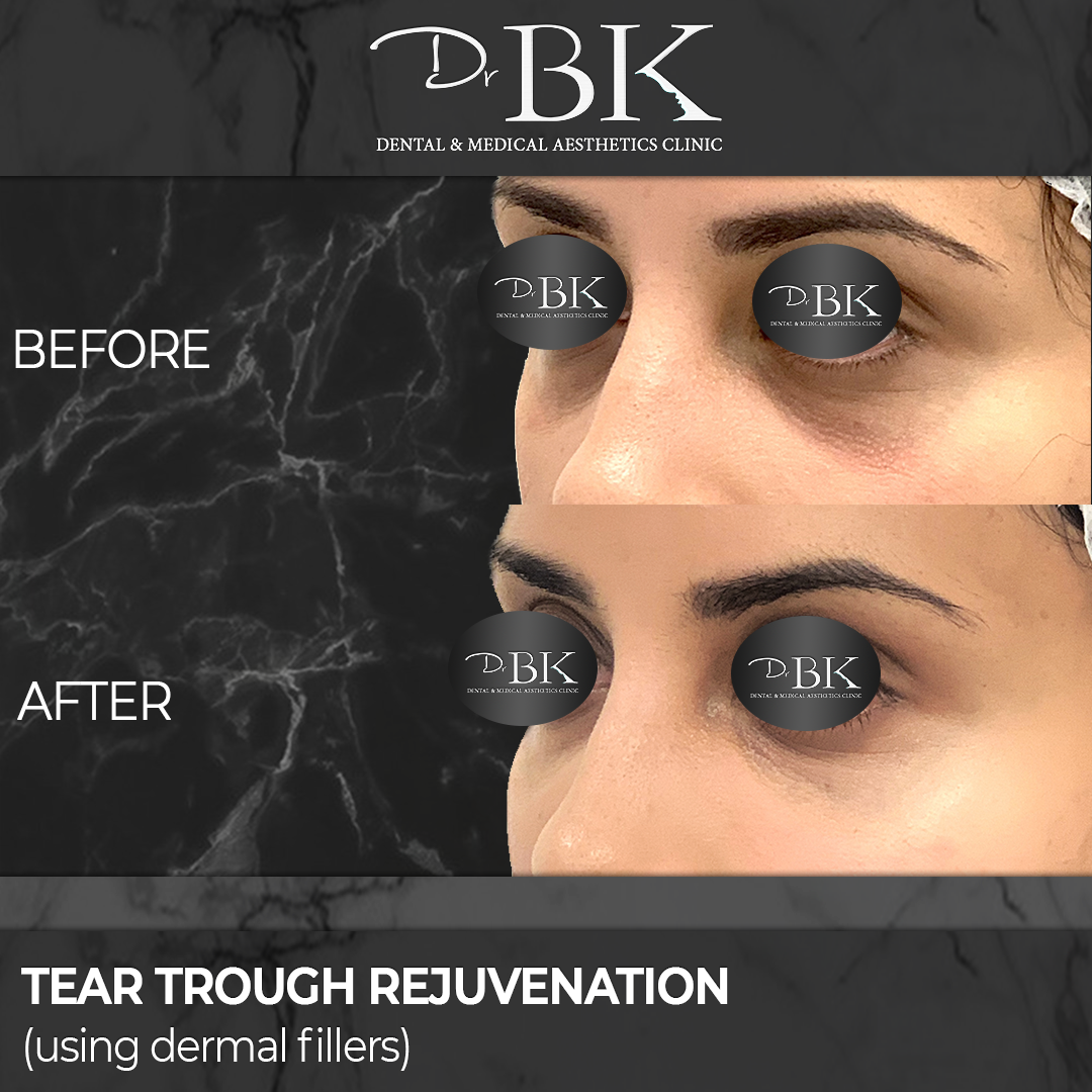 teartroughrejuvenation