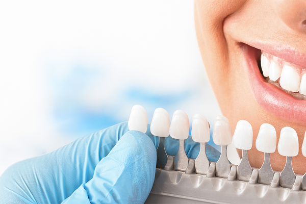 A photograph of a dentist holding a set of different coloured teeth up to the mouth of a patient for teeth whitening.