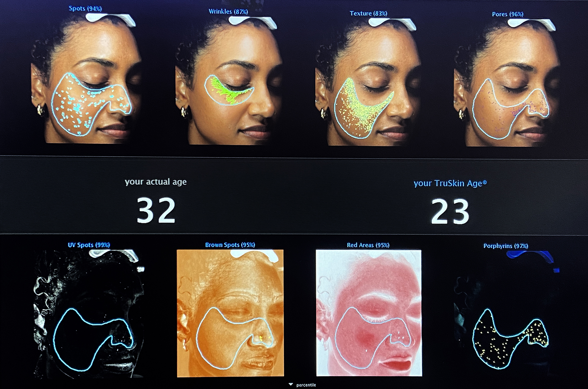 Reveal Your TRUSKIN Age®