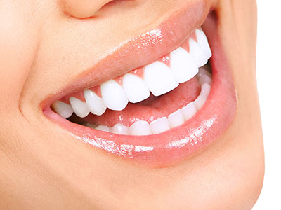 dental veneers cosmetic dentist reading